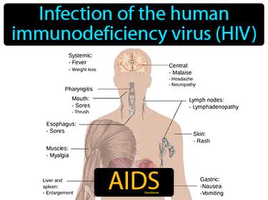 AIDS Simple Definition