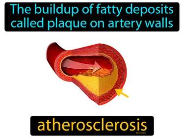 atherosclerosis Simple Definition