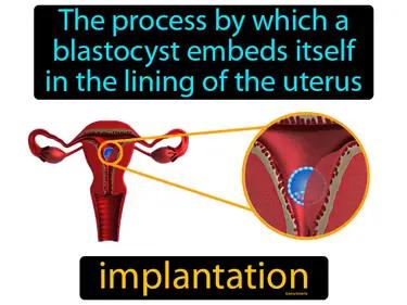 implantation Simple Definition