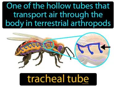 tracheal tube Simple Definition
