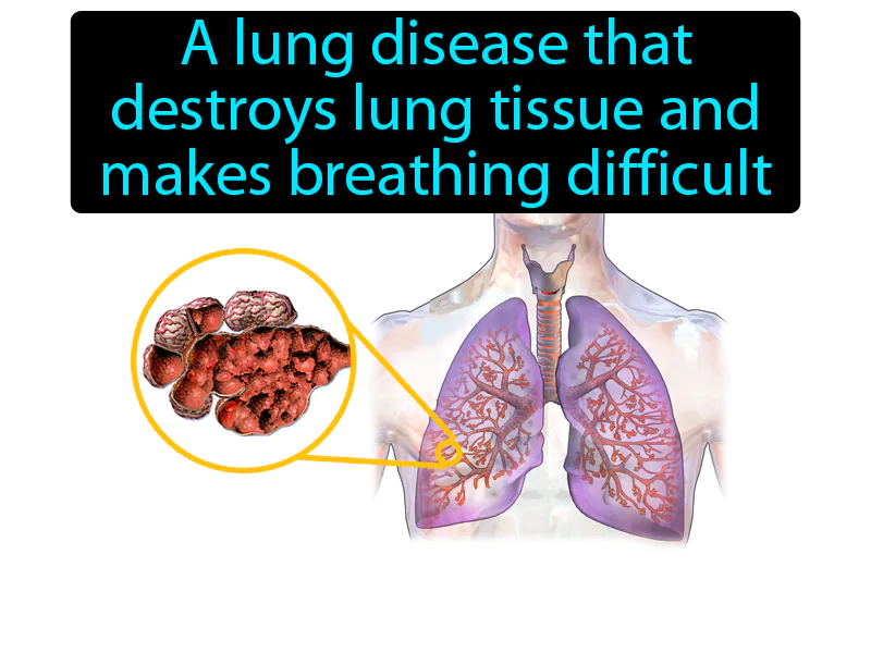 Emphysema Definition